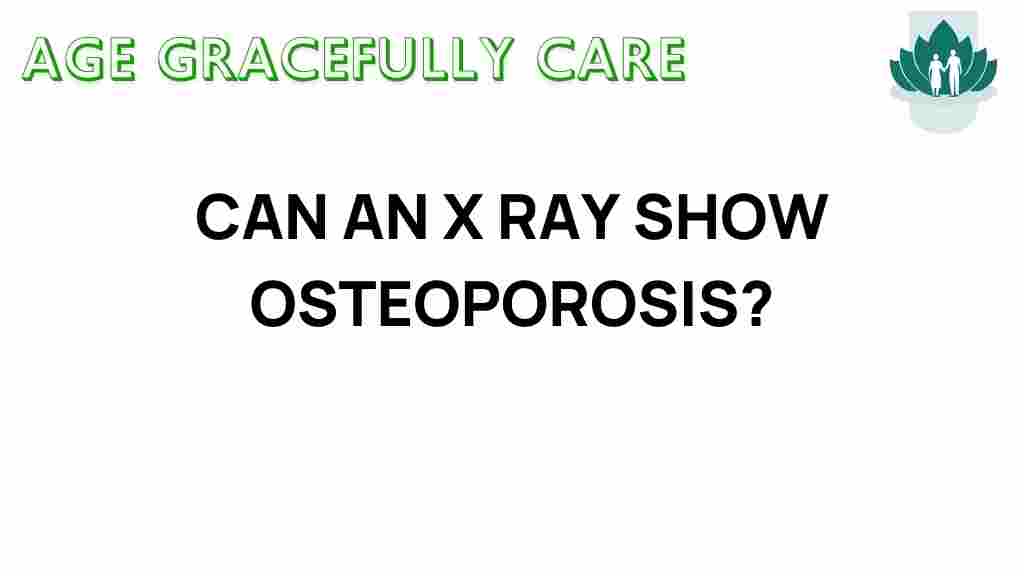 can-an-x-ray-show-osteoporosis