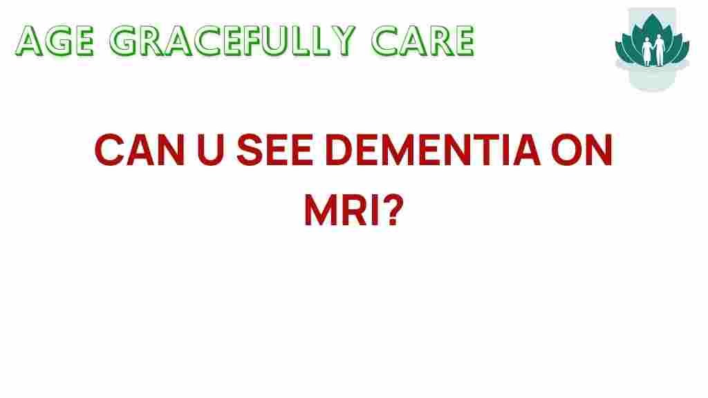 dementia-mri-signs